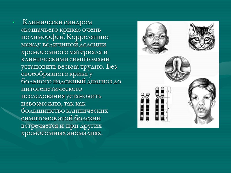 Клинически синдром «кошачьего крика» очень полиморфен. Корреляцию между величиной делеции хромосомного материала и клиническими